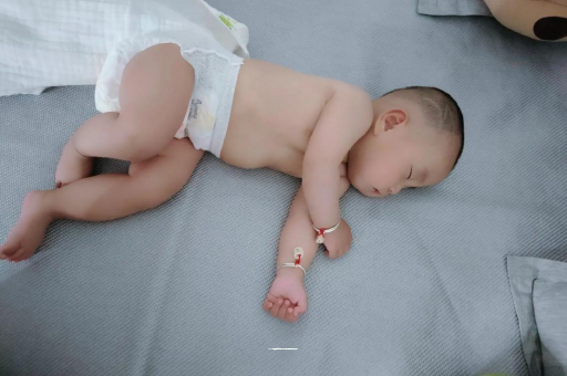 绵阳宝宝褶皱处擦粉还是油